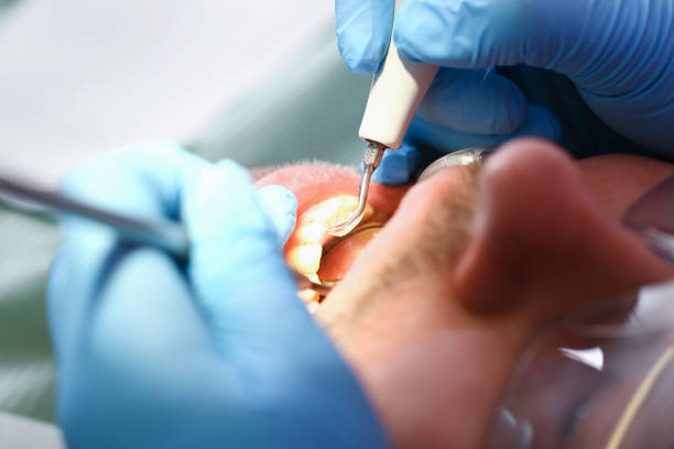 Best Holiday Emergency Dentist in Burlingame, CA