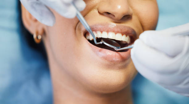 Best Weekend Emergency Dentist in Burlingame, CA